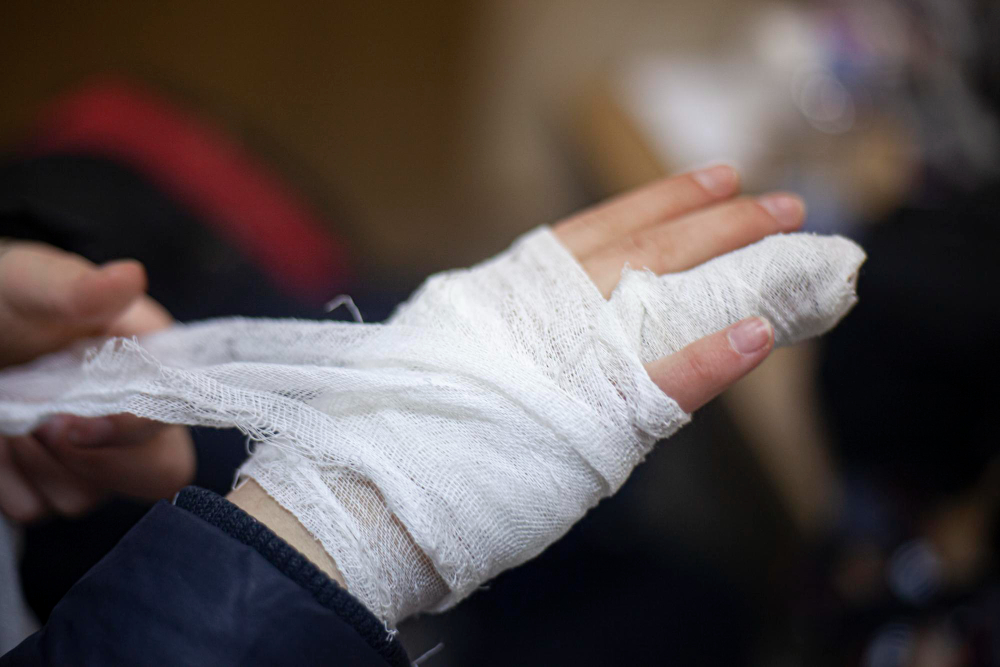 The Most Common Workers’ Comp Injuries: What You Need to Know
